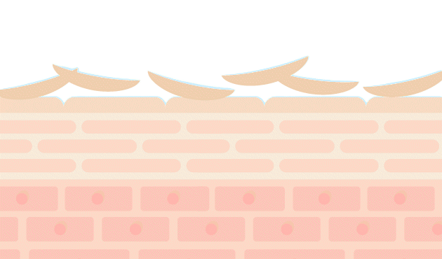 角質ケアで健やかな肌へ導く